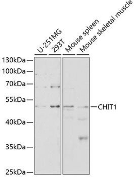Metabolism Antibodies 2 Anti-CHIT1 Antibody CAB2015