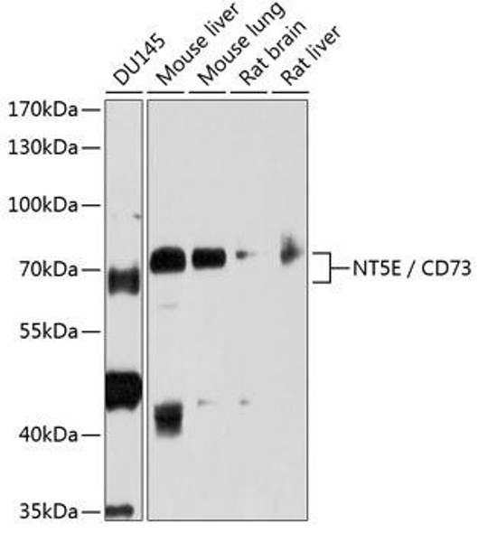 KO Validated Antibodies 1 Anti-NT5E / CD73 Antibody CAB2029KO Validated