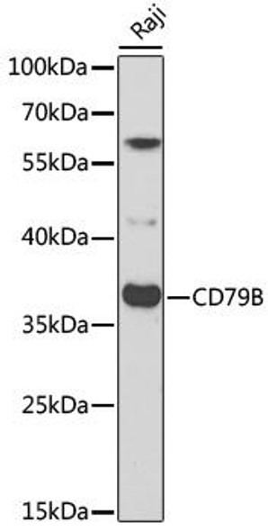 Immunology Antibodies 2 Anti-CD79B Antibody CAB2033