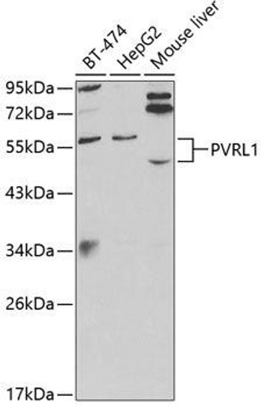 Cell Biology Antibodies 8 Anti-PVRL1 Antibody CAB2037