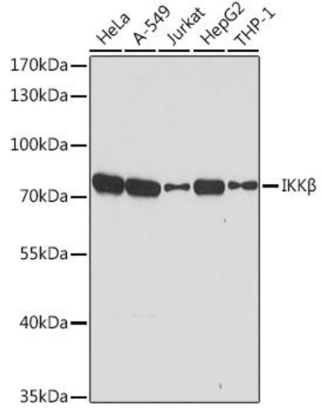 Immunology Antibodies 2 Anti-IKKBeta Antibody CAB2087