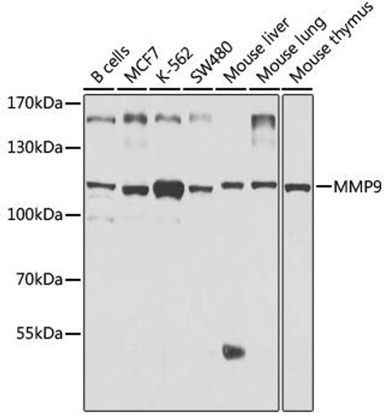 KO Validated Antibodies 1 Anti-MMP9 Antibody CAB2095KO Validated