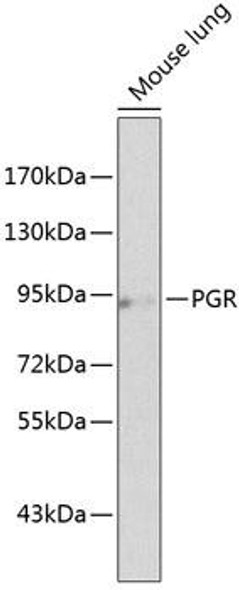Epigenetics and Nuclear Signaling Antibodies 3 Anti-PGR Antibody CAB2105