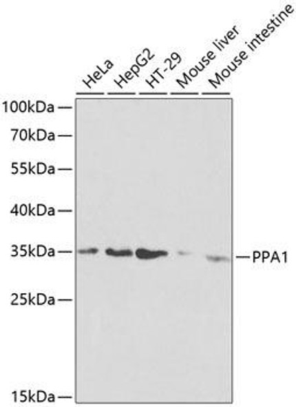 Cell Biology Antibodies 8 Anti-PPA1 Antibody CAB2108