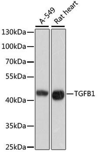 Cell Biology Antibodies 8 Anti-TGFB1 Antibody CAB2124