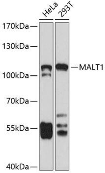 Signal Transduction Antibodies 2 Anti-MALT1 Antibody CAB2144