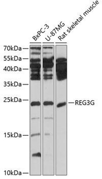 Cell Biology Antibodies 16 Anti-REG3G Antibody CAB2146