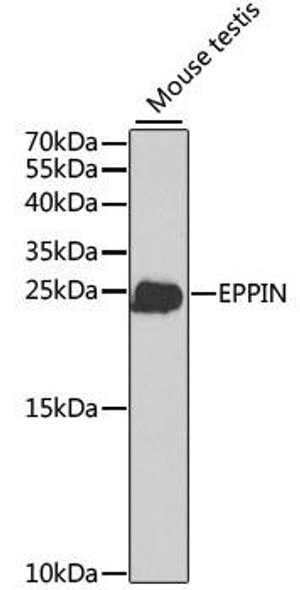 Cell Biology Antibodies 8 Anti-EPPIN Antibody CAB2149