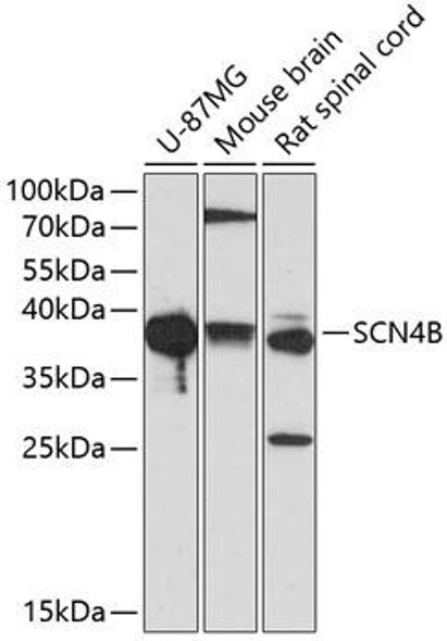 Cell Biology Antibodies 16 Anti-SCN4B Antibody CAB2154
