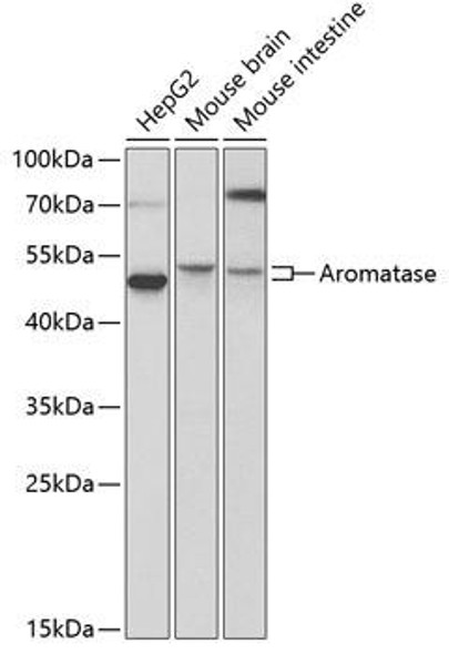 Cell Biology Antibodies 8 Anti-Aromatase Antibody CAB2161
