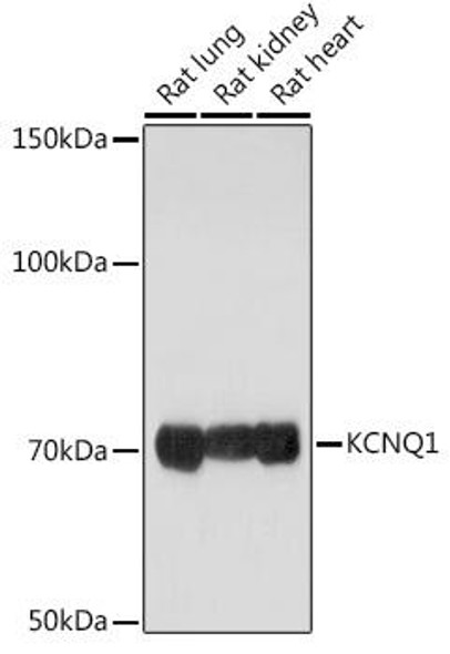 Signal Transduction Antibodies 2 Anti-KCNQ1 Antibody CAB2174