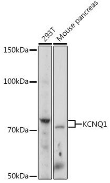 Signal Transduction Antibodies 2 Anti-KCNQ1 Antibody CAB2174
