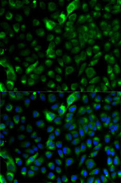 Cytokeratin 12 (KRT12) Antibody (CAB14746)