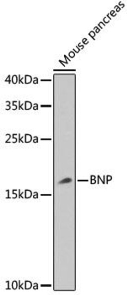 Signal Transduction Antibodies 2 Anti-BNP Antibody CAB2179