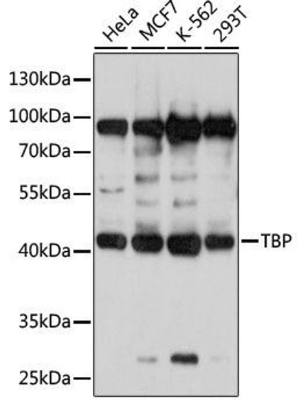 KO Validated Antibodies 1 Anti-TBP Antibody CAB2192KO Validated