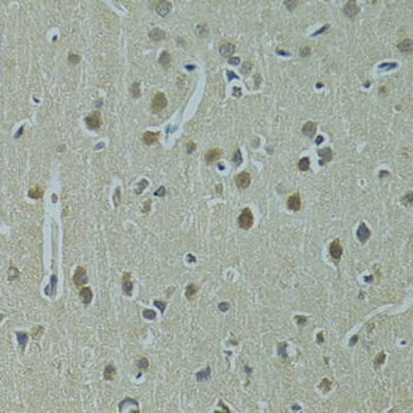 Cell Cycle Antibodies 1 Anti-UBE2I Antibody CAB2193