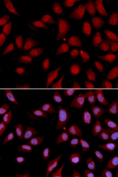 Cell Cycle Antibodies 1 Anti-DLGAP5 Antibody CAB2197