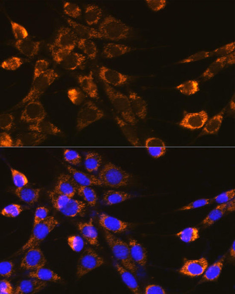 Cell Biology Antibodies 8 Anti-ITGB1 Antibody CAB2217