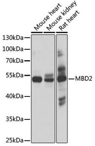 Epigenetics and Nuclear Signaling Antibodies 3 Anti-MBD2 Antibody CAB2241