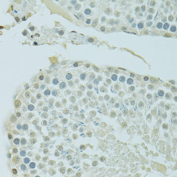 Epigenetics and Nuclear Signaling Antibodies 3 Anti-BRD3 Antibody CAB2277