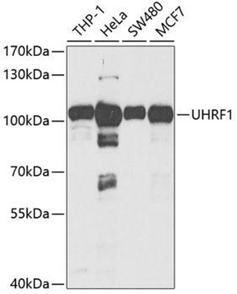 Cell Cycle Antibodies 1 Anti-UHRF1 Antibody CAB2343