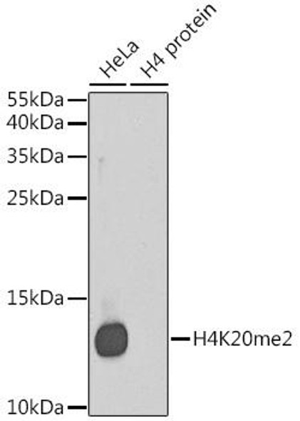 Cell Biology Antibodies 8 Anti-DiMethyl-Histone H4-K20 Antibody CAB2371