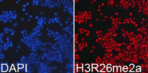 Epigenetics and Nuclear Signaling Antibodies 3 Anti-Asymmetric DiMethyl-Histone H3-R26 Antibody CAB2375