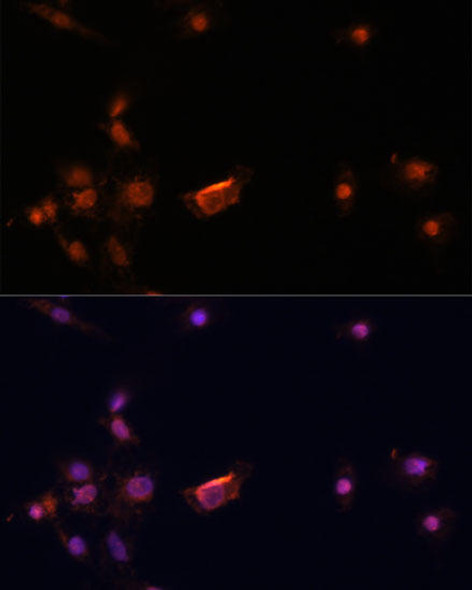 Cell Cycle Antibodies 1 Anti-BRCA2 Antibody CAB2435