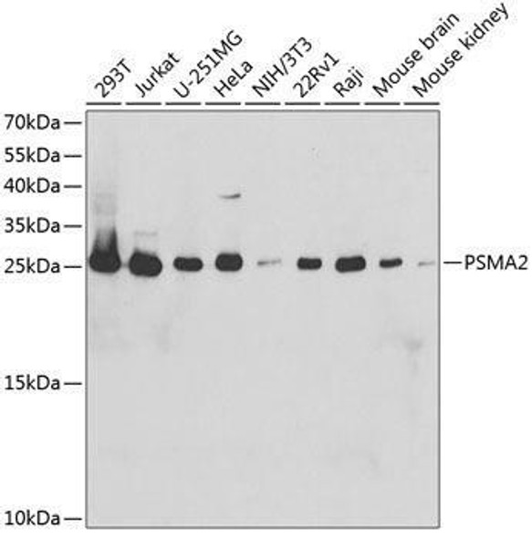 Cell Biology Antibodies 8 Anti-PSMA2 Antibody CAB2504