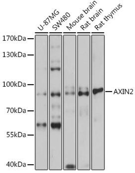 Metabolism Antibodies 2 Anti-AXIN2 Antibody CAB2513