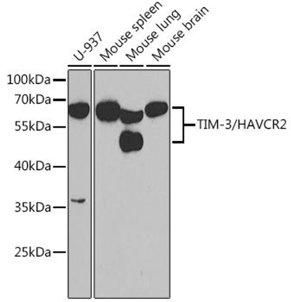 Immunology Antibodies 2 Anti-TIM-3/HAVCR2 Antibody CAB2516