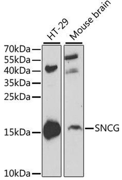 Cell Biology Antibodies 8 Anti-SNCG Antibody CAB2524