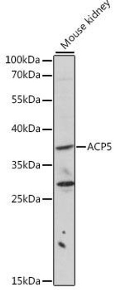 Cell Biology Antibodies 8 Anti-ACP5 Antibody CAB2528