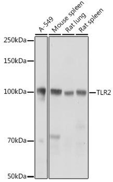 Immunology Antibodies 2 Anti-TLR2 Antibody CAB2545