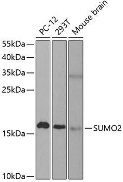 Signal Transduction Antibodies 2 Anti-SUMO2 Antibody CAB2571