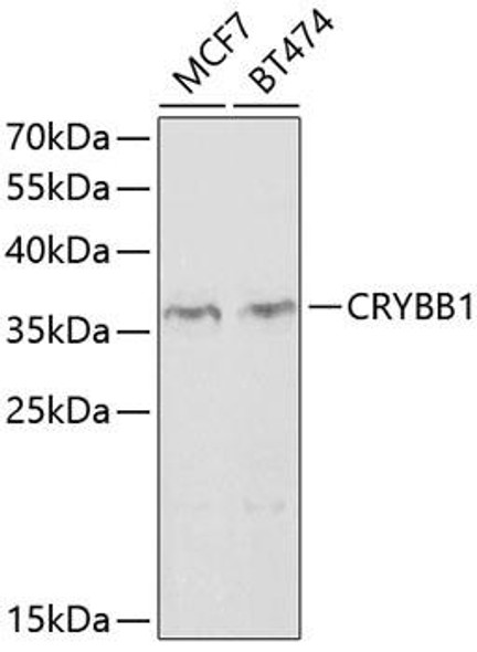 Cell Biology Antibodies 8 Anti-CRYBB1 Antibody CAB2590