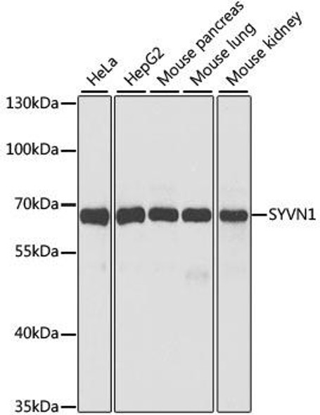 Metabolism Antibodies 2 Anti-SYVN1 Antibody CAB2605