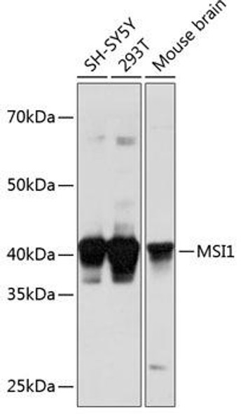 Cell Biology Antibodies 8 Anti-MSI1 Antibody CAB2609