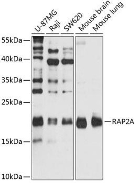 Cell Biology Antibodies 8 Anti-RAP2A Antibody CAB2616