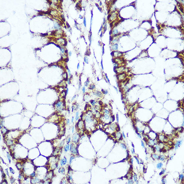 Cell Biology Antibodies 8 Anti-COX5B Antibody CAB2640