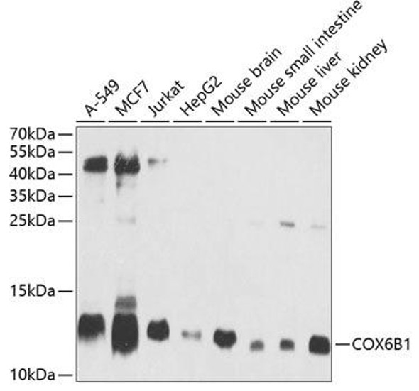 Cell Biology Antibodies 8 Anti-COX6B1 Antibody CAB2641