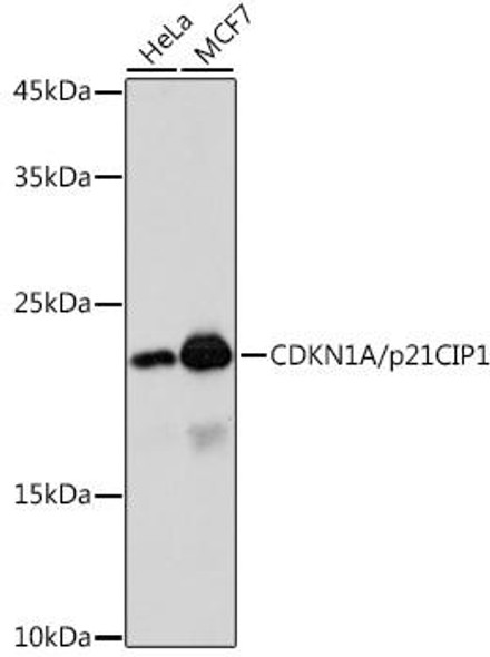 KO Validated Antibodies 1 Anti-CDKN1A/p21CIP1 Antibody CAB2691KO Validated
