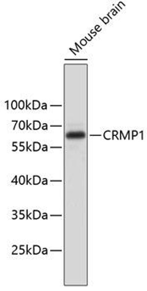 Cell Biology Antibodies 8 Anti-CRMP1 Antibody CAB2705