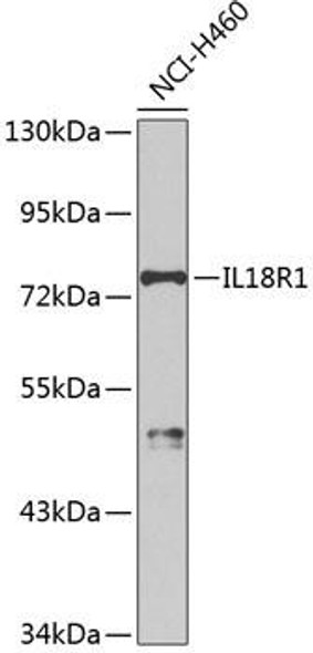 Immunology Antibodies 2 Anti-IL-18R1 Antibody CAB2706