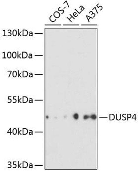 Cell Biology Antibodies 8 Anti-DUSP4 Antibody CAB2726