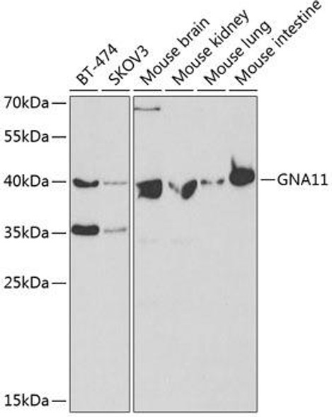 Cell Biology Antibodies 8 Anti-GNA11 Antibody CAB2731