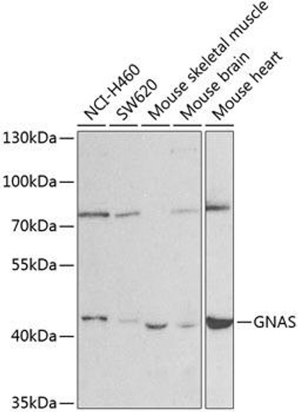 Cell Biology Antibodies 8 Anti-GNAS Antibody CAB2732