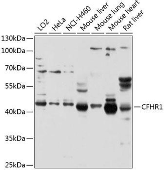 Cell Biology Antibodies 8 Anti-CFHR1 Antibody CAB2743