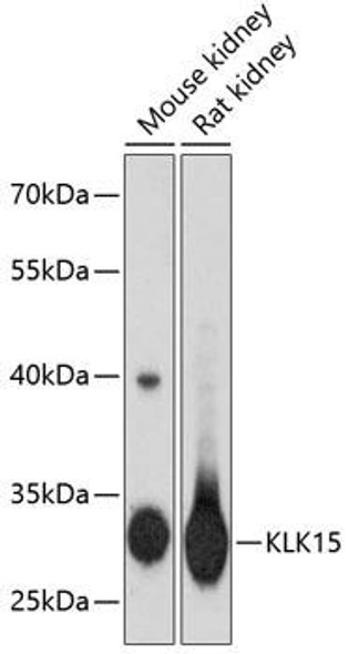 Cell Biology Antibodies 8 Anti-KLK15 Antibody CAB2757