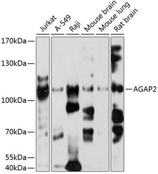 Cell Biology Antibodies 8 Anti-AGAP2 Antibody CAB2759